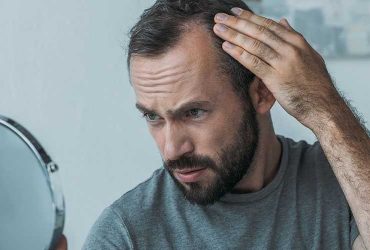How To Get Natural Hairline By Hair Transplantation