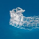 Get clear aligners in Lahore Pakistan